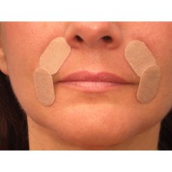 Rynkeplaster til lbelinjer<br /> omkring munden
