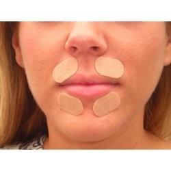 Rynkeplaster til lbelinjer<br /> omkring munden